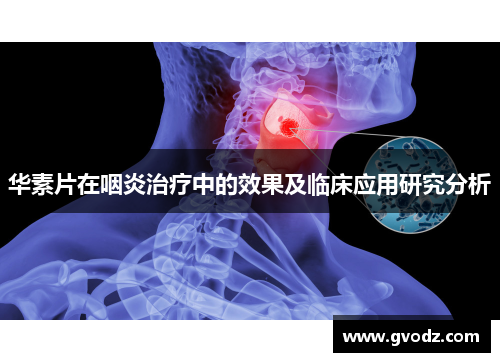 华素片在咽炎治疗中的效果及临床应用研究分析