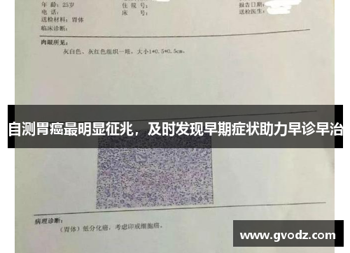 自测胃癌最明显征兆，及时发现早期症状助力早诊早治